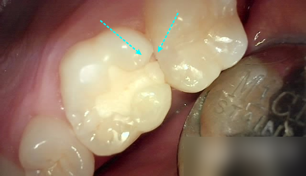 Treatment case image 1