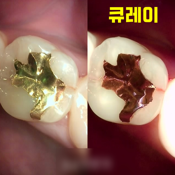 Treatment case image 1