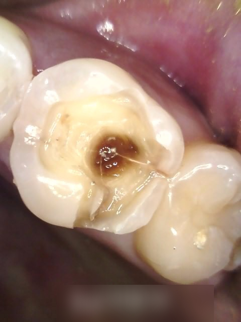 Treatment case image 3