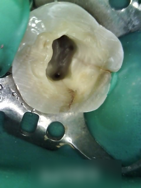 Treatment case image 4