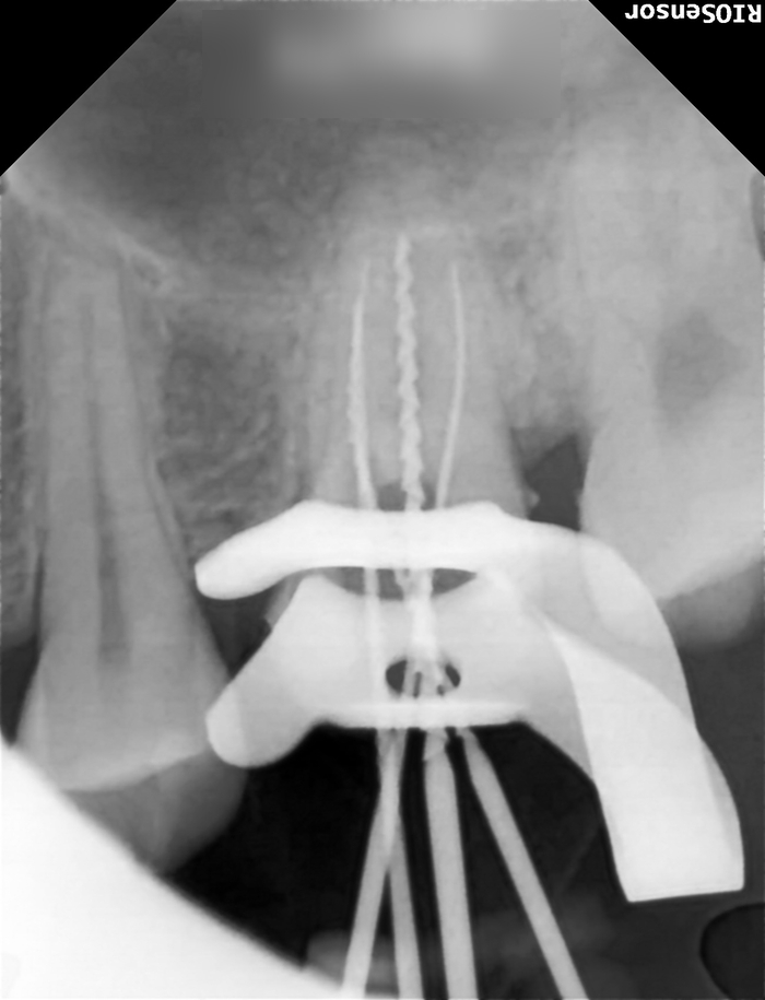 Treatment case image 5