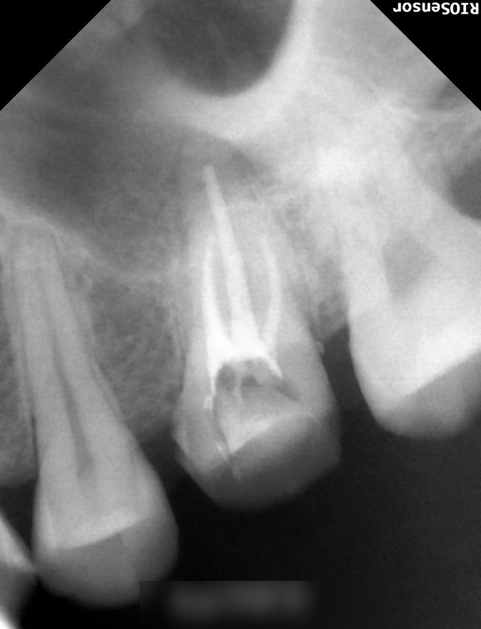 Treatment case image 6