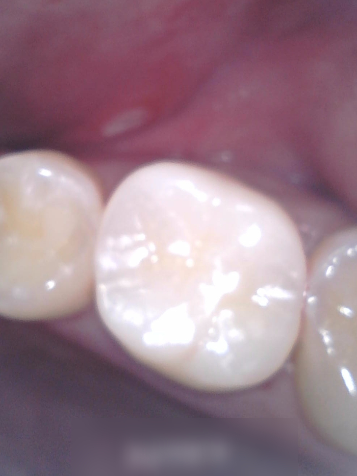 Treatment case image 11