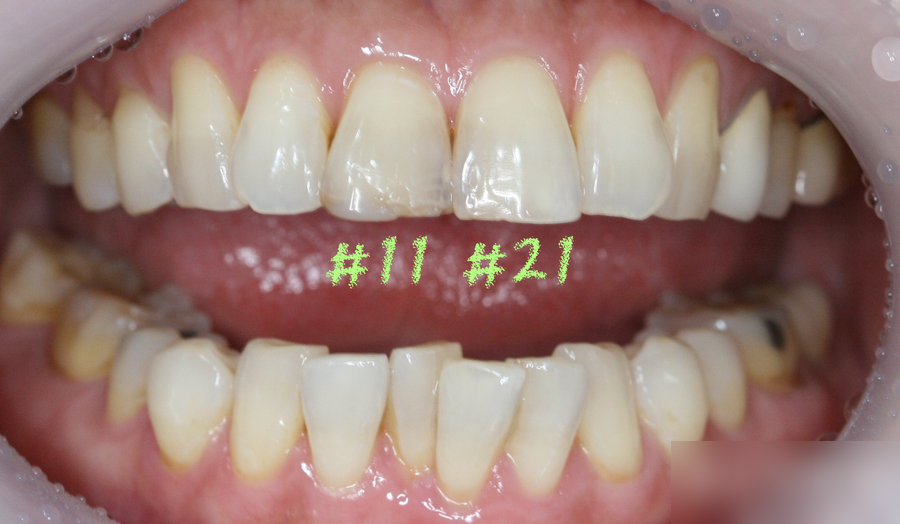 Treatment case image 1