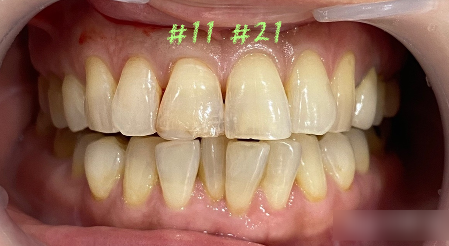 Treatment case image 2