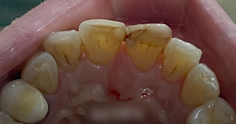 Treatment case image 3