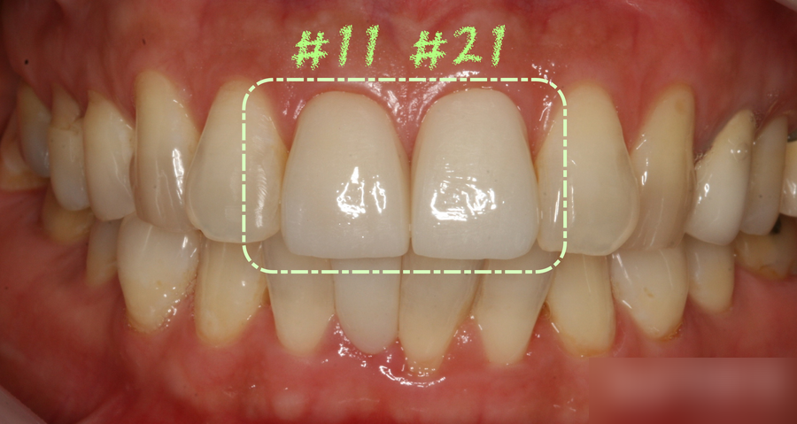 Treatment case image 5