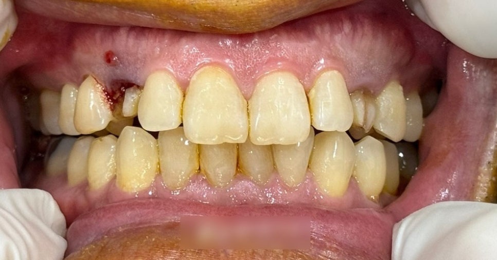 Treatment case image 1