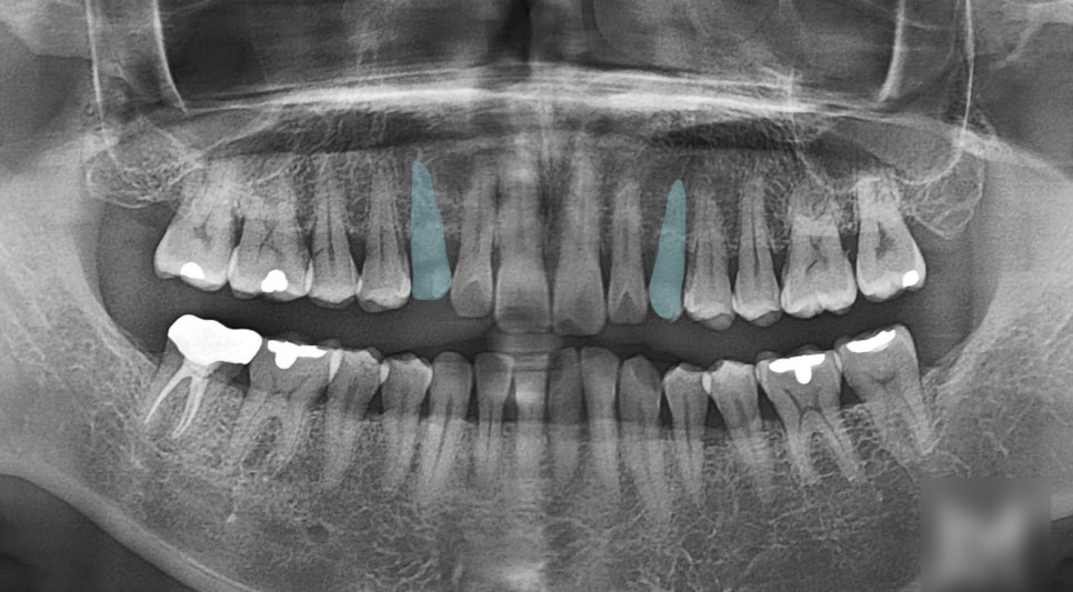 Treatment case image 2