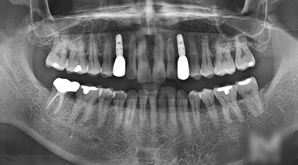 Treatment case image 4