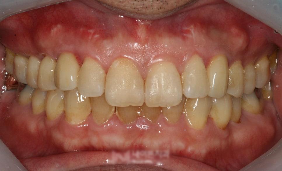 Treatment case image 6