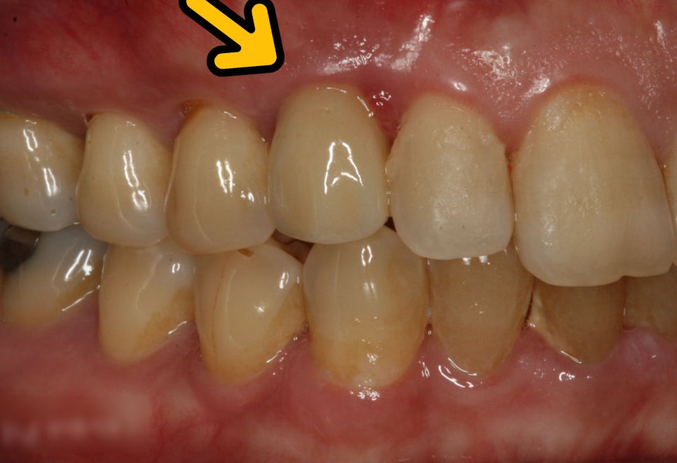 Treatment case image 7