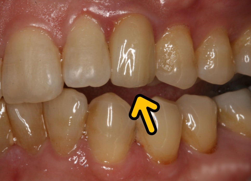 Treatment case image 8