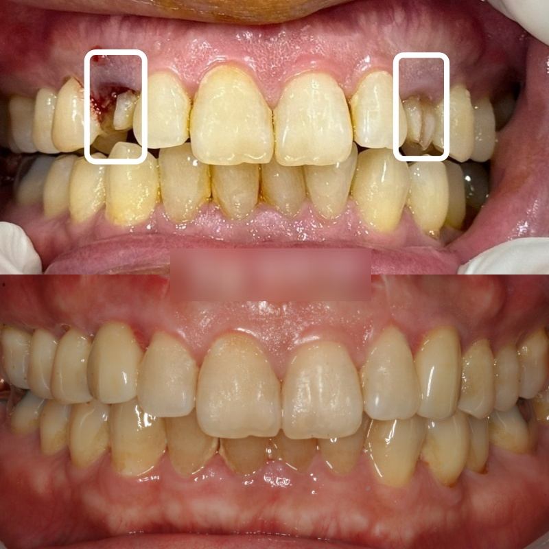Treatment case image 9