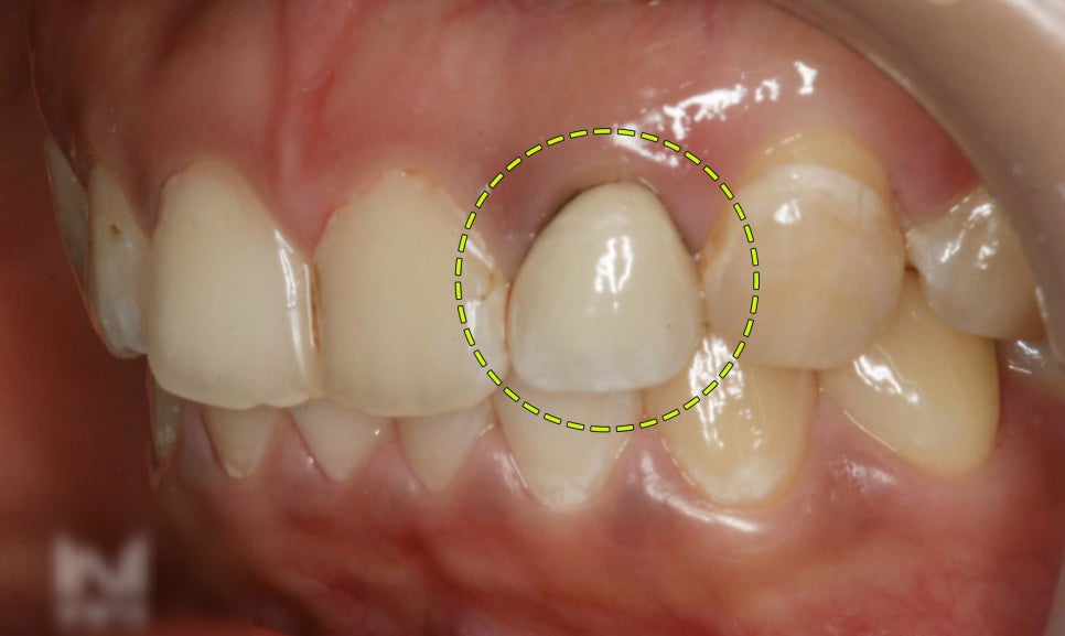 Treatment case image 1