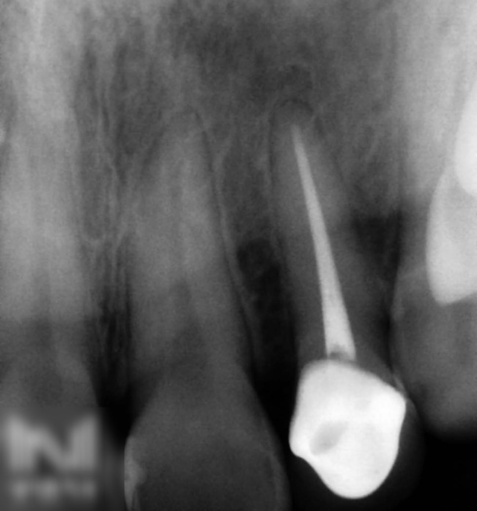 Treatment case image 2