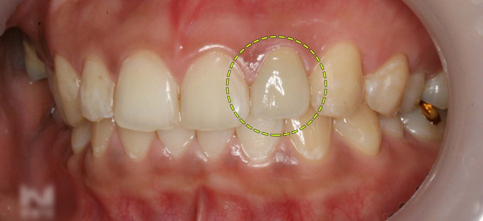 Treatment case image 3