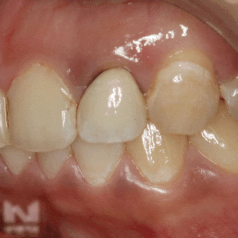 Treatment case image 6