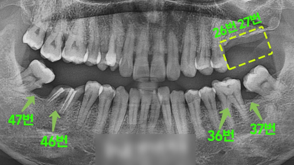 Treatment case image 1