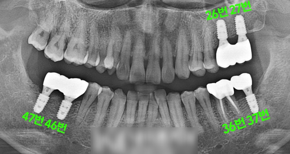 Treatment case image 3