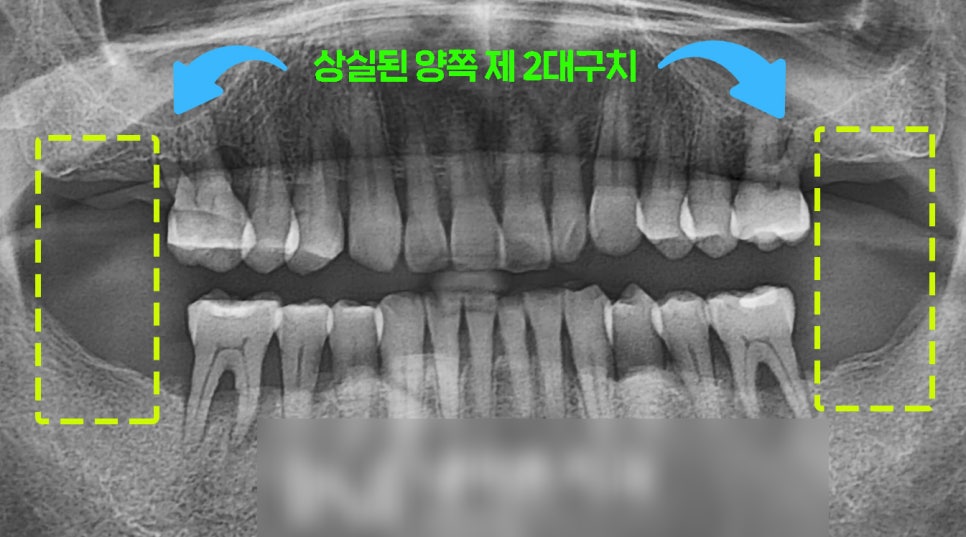 Treatment case image 1