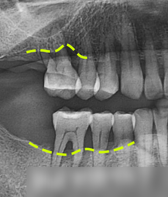 Treatment case image 2