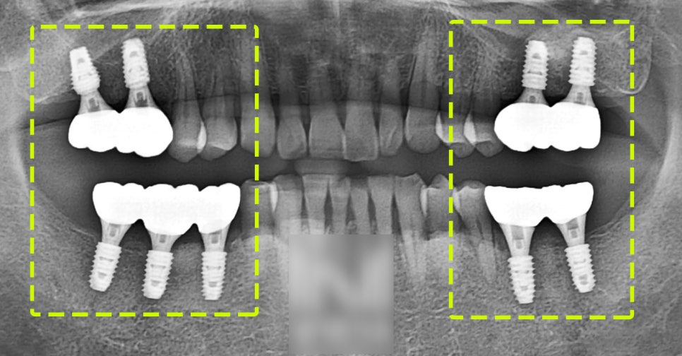 Treatment case image 4