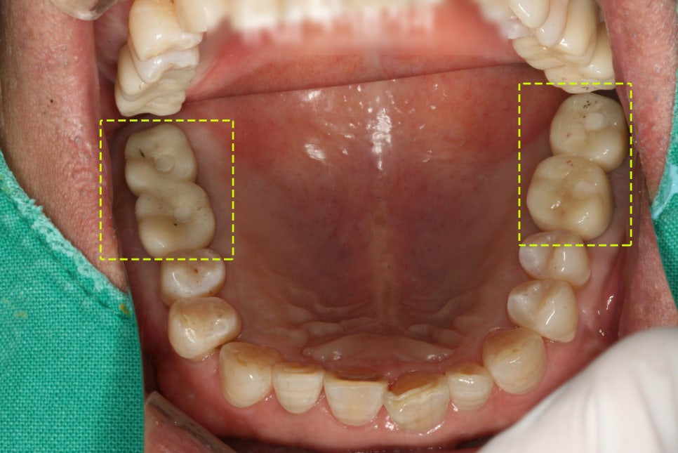 Treatment case image 6