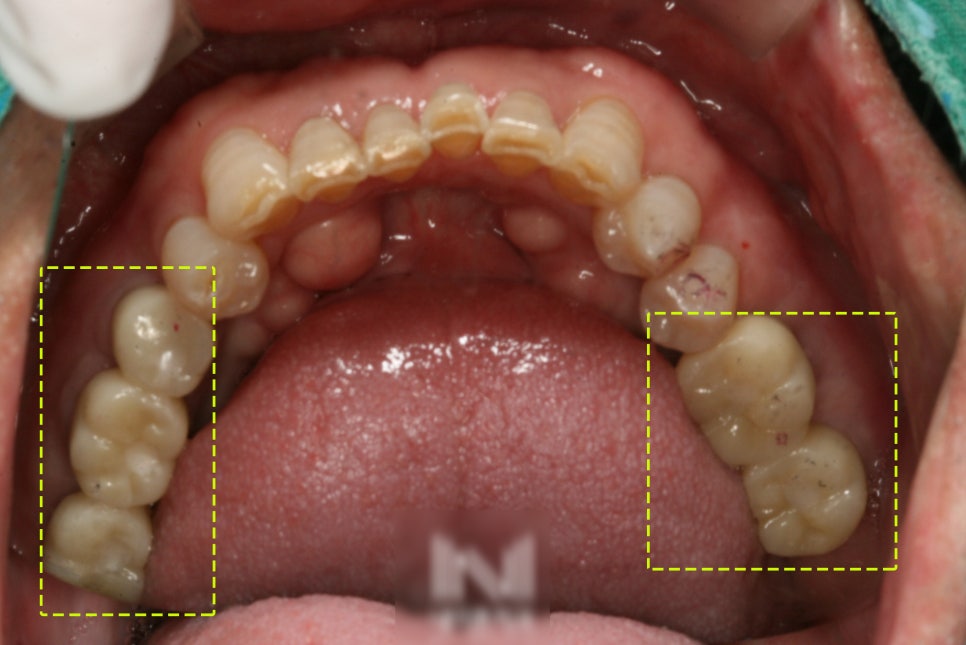 Treatment case image 7