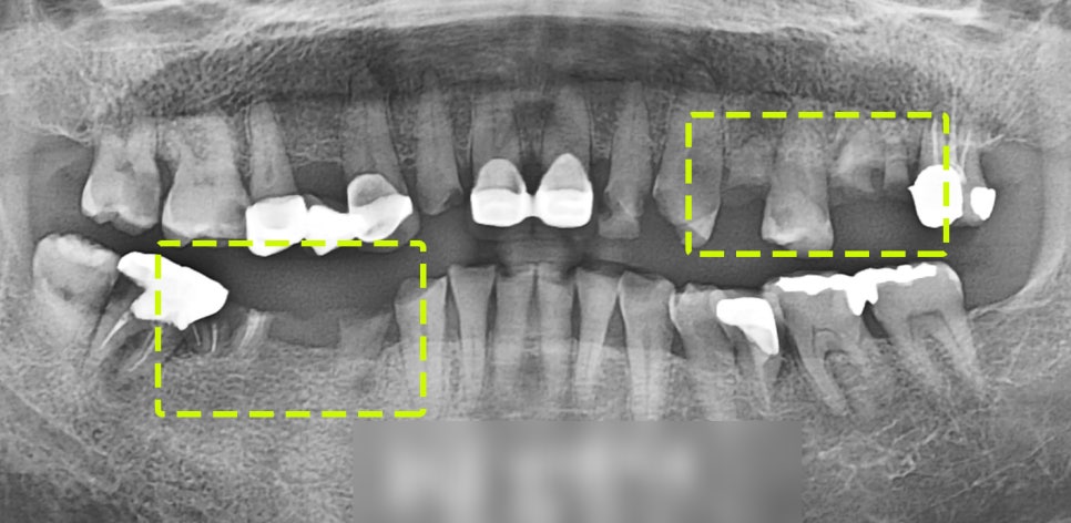 Treatment case image 1