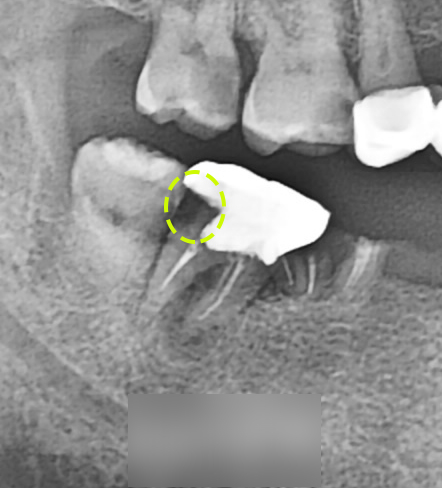 Treatment case image 3