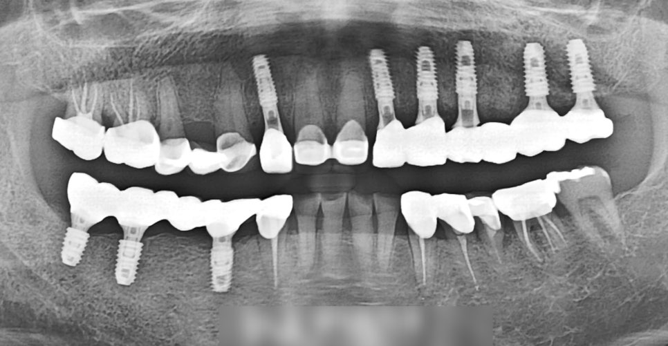 Treatment case image 4