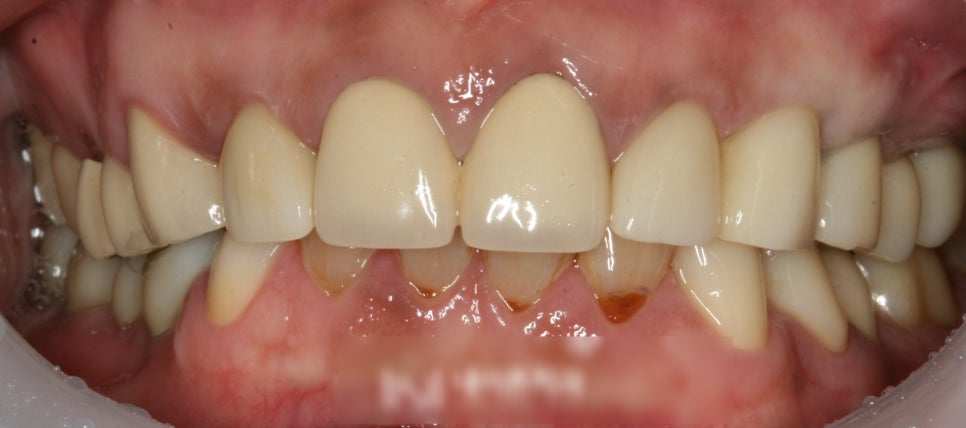 Treatment case image 6