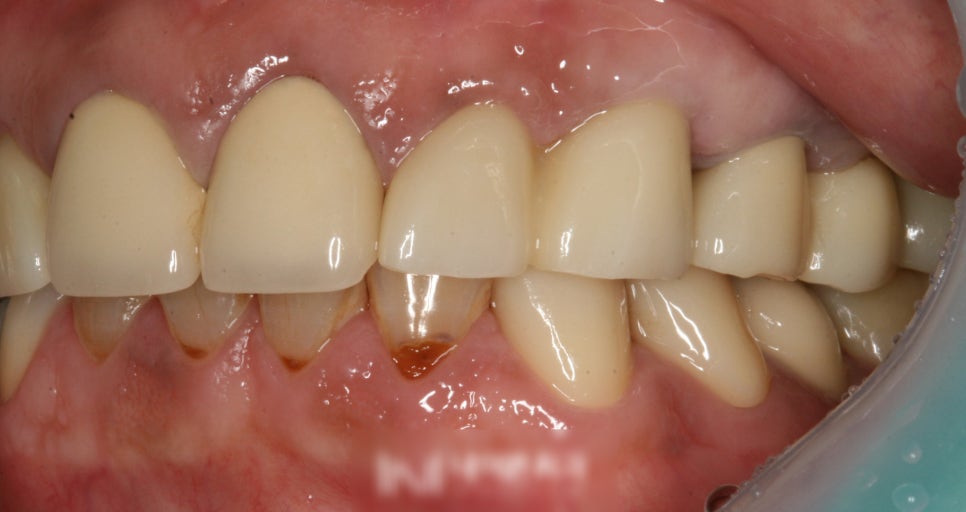 Treatment case image 7