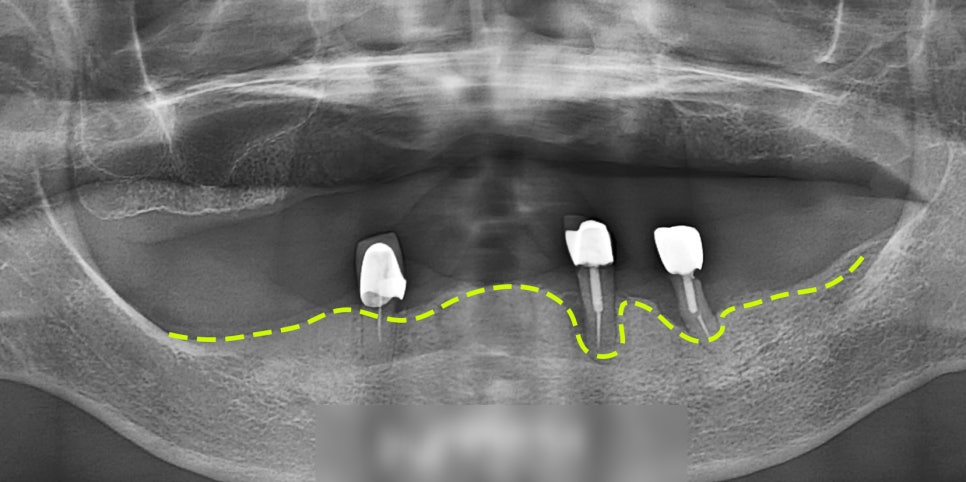 Treatment case image 1