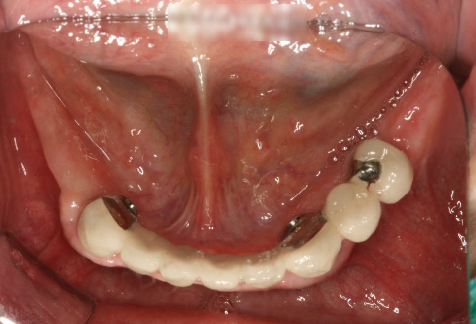 Treatment case image 2