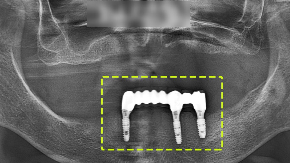 Treatment case image 3