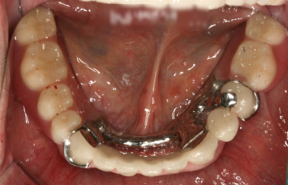 Treatment case image 4