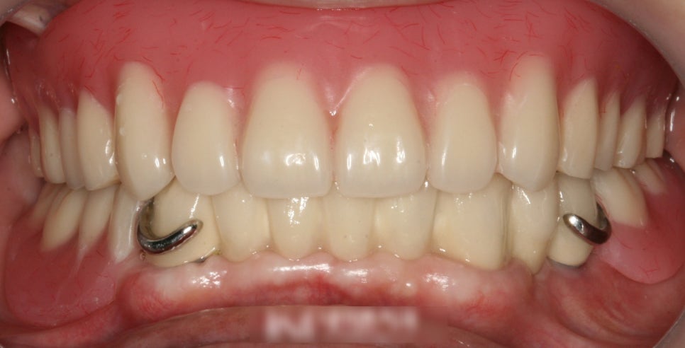 Treatment case image 5