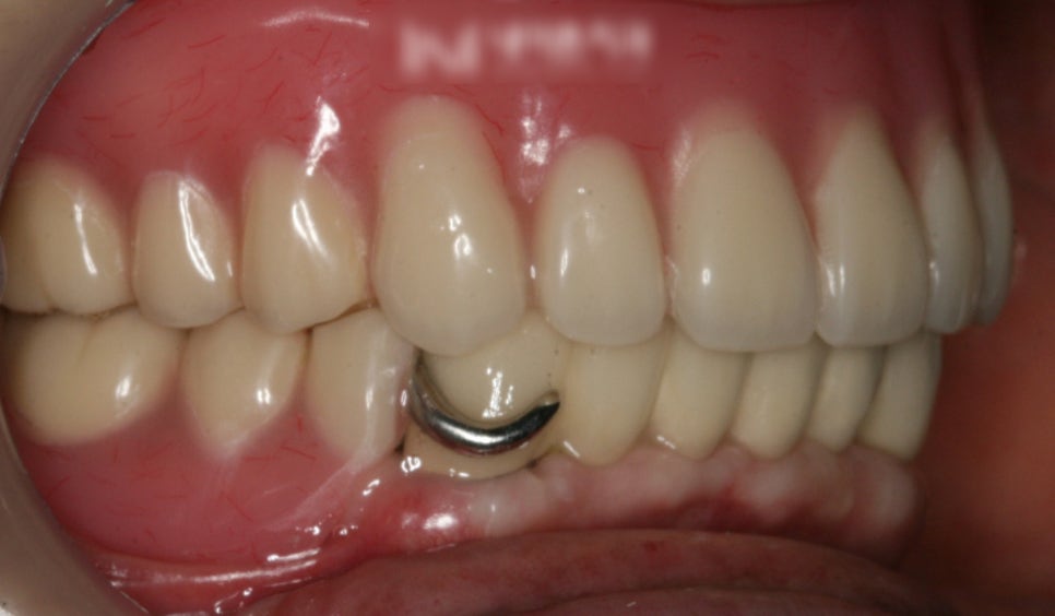 Treatment case image 6