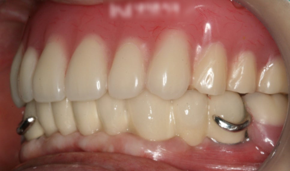Treatment case image 7