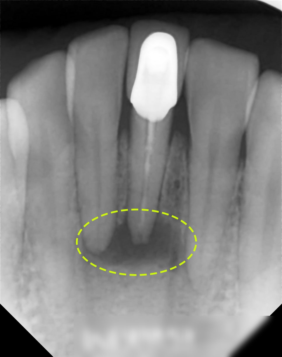 Treatment case image 1