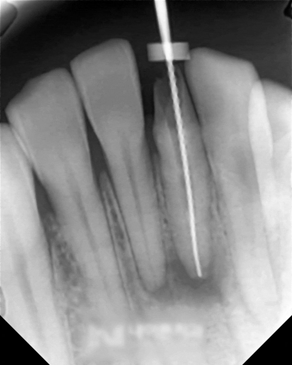 Treatment case image 3