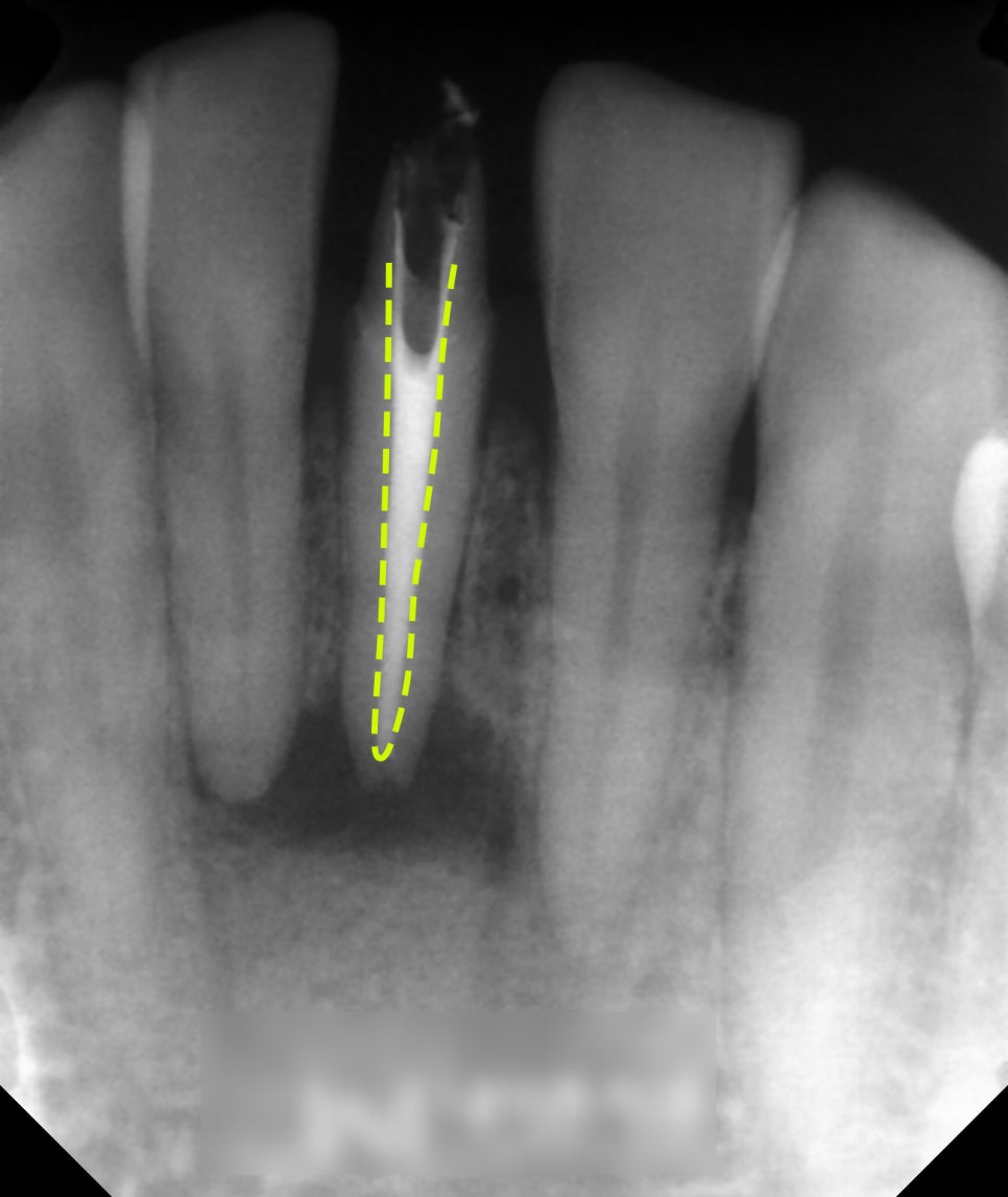 Treatment case image 5