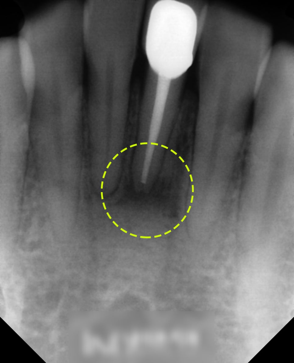 Treatment case image 6