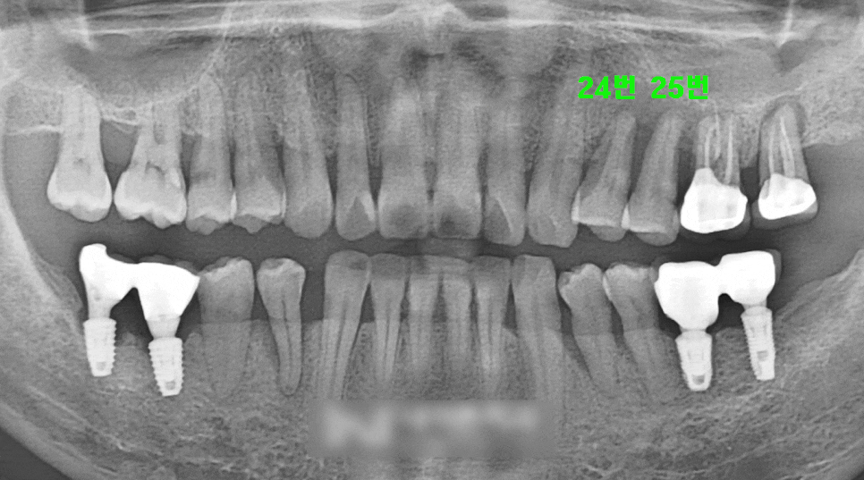 Treatment case image 1