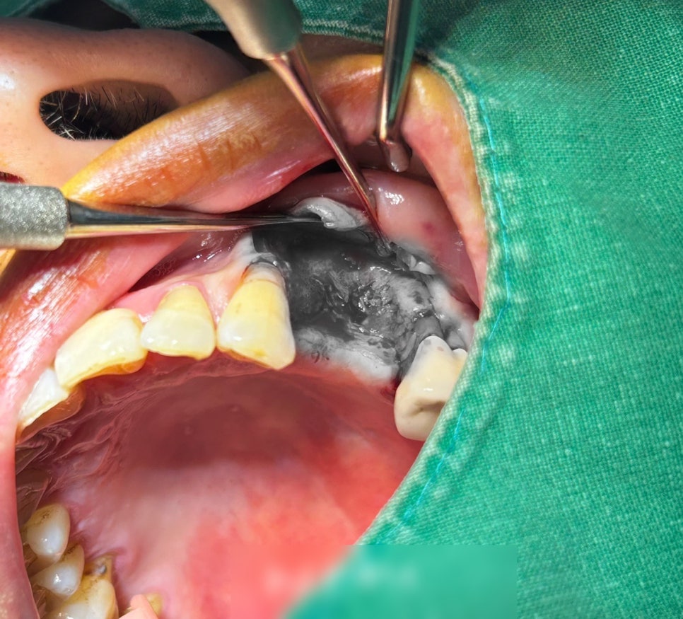 Treatment case image 3