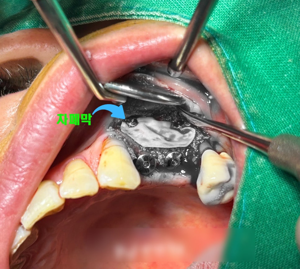 Treatment case image 4
