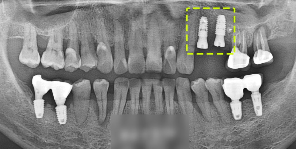 Treatment case image 5