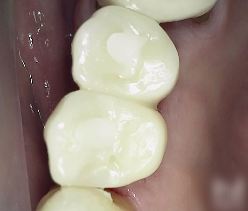Treatment case image 6